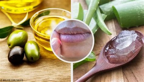 Cura Tus Labios Quemados Con Estos Remedios Naturales Mejor Con Salud