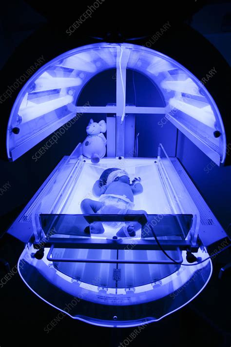 Phototherapy For Jaundice