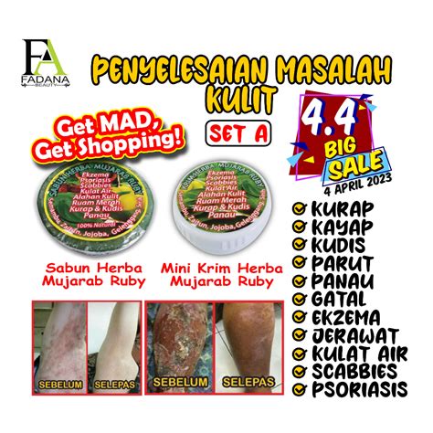 Set A Ruby Cream Masalah Kulit Gatal Eczema Kurap Kudis Krim Psoriasis