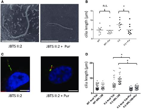 Rescue Of CEP290 Mutant Cilia Length Defects In HURECs Using