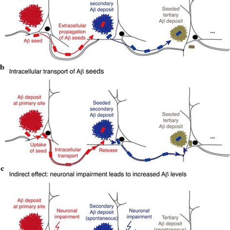 Human Brain Tau Pathology Precedes A Deposits In The Outer Molecular