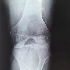 Knee MRI axial view. | Download Scientific Diagram