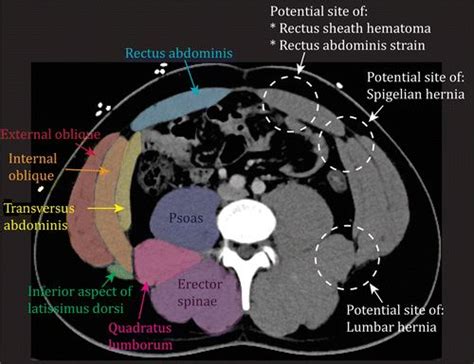 Pin By Aleksandra Stawik On Medyczne Medical Radiography Radiology