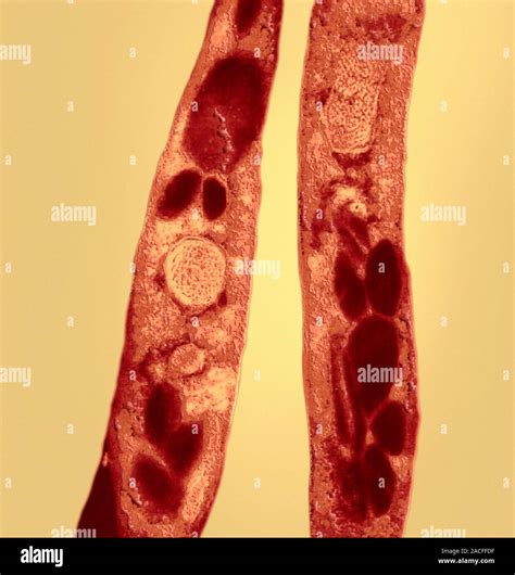 Anthrax Bacteria Coloured Transmission Electron Micrograph Of Bacillus