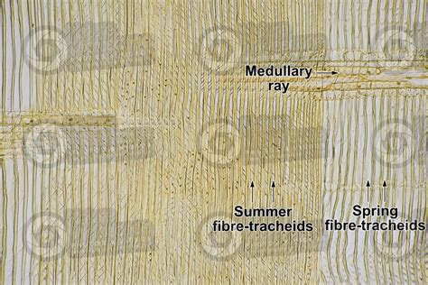 Radial Section Of Pine Wood