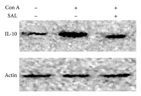 The Effect Of Salidroside Pretreatment On Il Protein Expression