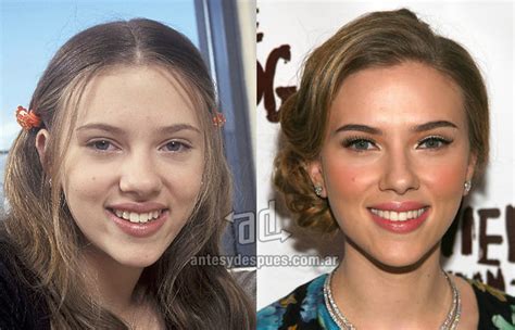 Celebrities With Plastic Surgery Before And After Photos