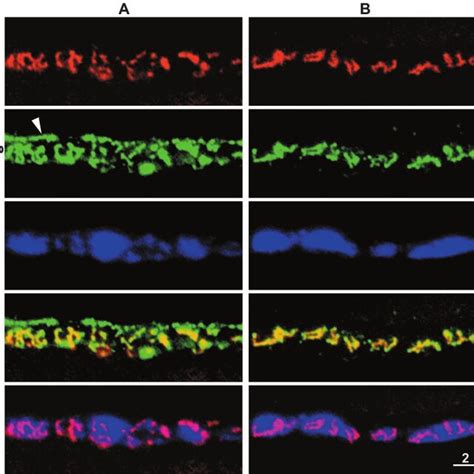 Synaptic And Nonsynaptic Staining Patterns After Treatment With