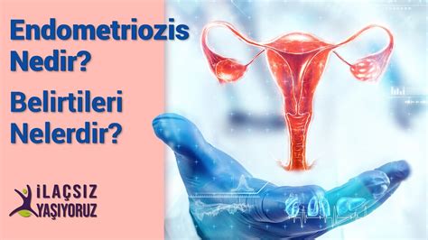 Endometriozis Nedir Endometriozis Belirtileri Nelerdir Nas L Ge Er