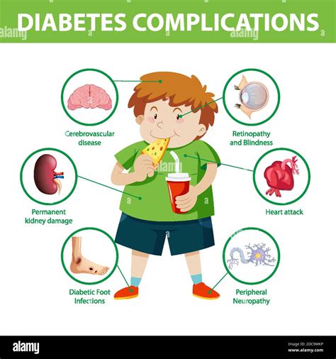 Diabetes Complications Information Infographic Illustration Stock