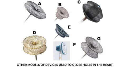 KEY-HOLE METHOD OF CLOSING HOLE IN THE HEART - Dr.PL. SaravananDr.PL. Saravanan