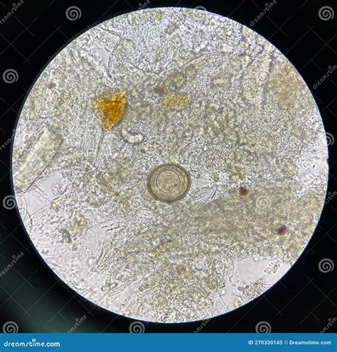 Hymenolepis Diminuta Egg Human Parasite in Stool Examination Stock ...