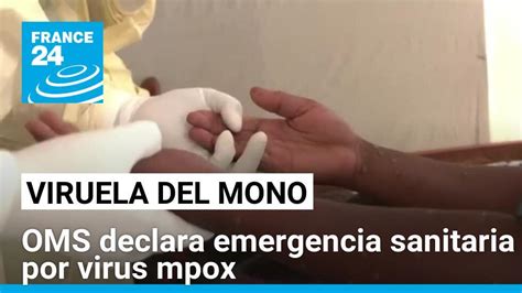 La Oms Declara Emergencia Sanitaria Internacional Por Brote De Mpox O Viruela Del Mono France 24