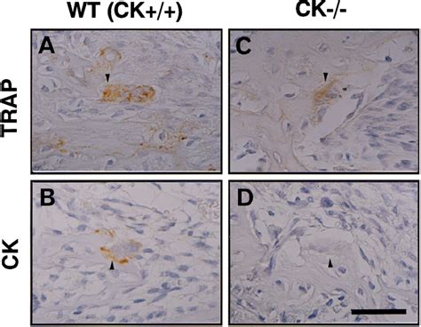 Immunohistochemical Localization Of TRAP And CK In Mouse Mandibular