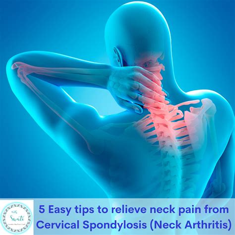 5 Easy tips to relieve neck pain from Cervical Spondylosis (Neck Arthritis) | Swati Prakash