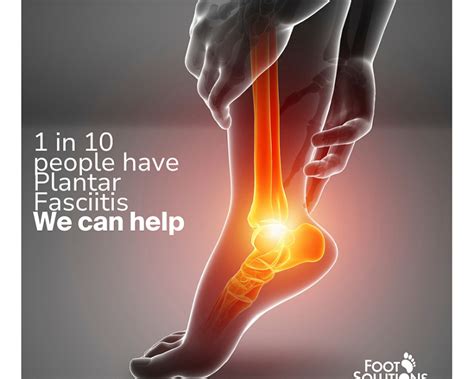 Plantar Fasciitis How To Help Foot Solutions Comfort Footwear Specialists