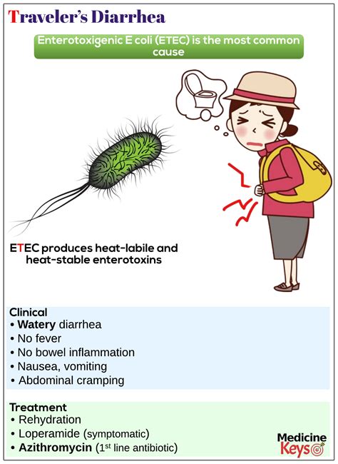 Traveler’s diarrhea - Medicine Keys for MRCPs