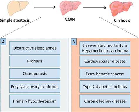 Complications Morbidity And Mortality Of Nonalcoholic Fatty Liver Disease Metabolism