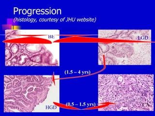 Endoscopy In Gastrointestinal Oncology Slide A Chak Risk