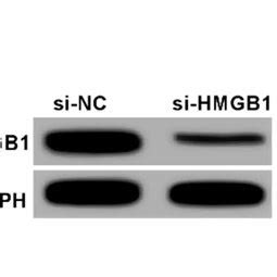 Knockdown Of Hmgb Inhibited Hmgb Expression In Uterine Fibroid Cells