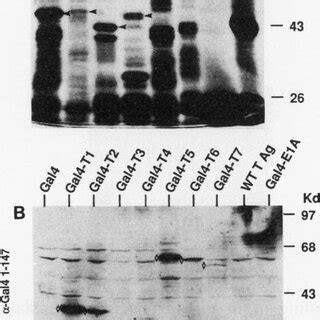 A Silver Stained Sds Page Gel Of Gst Fusion Proteins Eluted From