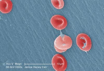 Hemoglobin | Define Hemoglobin at Dictionary.com