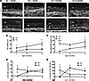 Jci Insight Development Of An Airway Mucus Defect In The Cystic