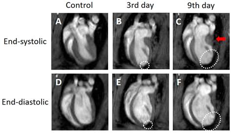 Tomography Free Full Text Application Of Magnetic Resonance Strain Analysis Using Feature