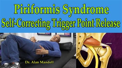 Piriformis Trigger Point Release