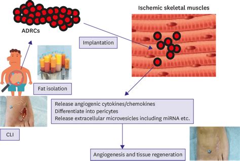 Mechanisms For The ADRCs Mediated Angiogenesis In Ischemic Tissues