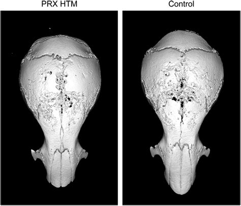 Mice Calvaria Days After The Implantation Of Wear Particles