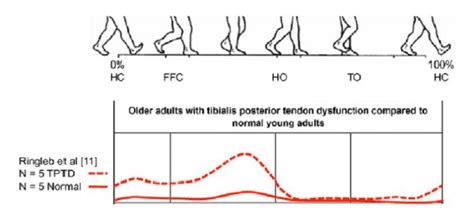 File:PTTD.jpg - Physiopedia