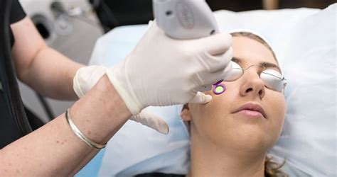 Complete Skin Specialists Laser Treatment Complete Skin Specialists