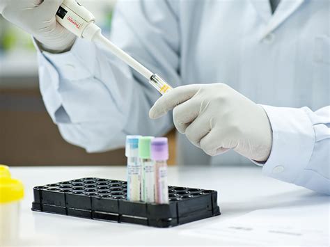 laboratory kempas medical centre johor bahru