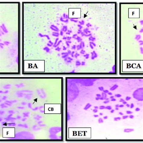 Photomicrographs Of Bone Marrow Metaphase Chromosome Spreads Of Rats C