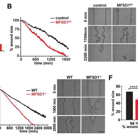 Mfsd Suppresses Cell Migration A Western Blot Of Mc Cells