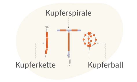 Verhütungsmethoden Welche Optionen zur Vergütung gibt es