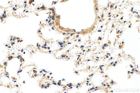 Calreticulin Antibody 10292 1 Ap Proteintech 武汉三鹰生物技术有限公司