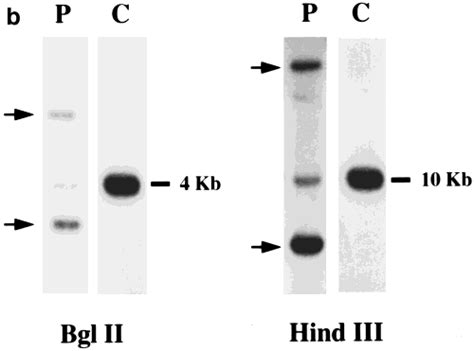 A Composite Figure Of The Five Pcr Detectable Igh Gene Rearrangements