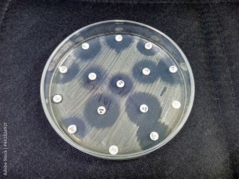 Antimicrobial Susceptibility Testing In Culture Plate Drug Sensitivity