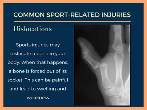 Common Sport Injuries And First Aid Procedurespptx