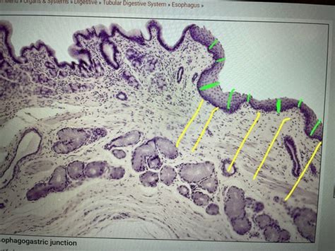 Lab 11 esophagus - stomach junction slide Flashcards | Quizlet