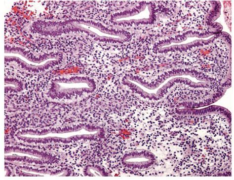 Histology Endometrial Dating – Telegraph