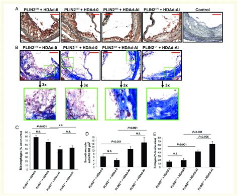 Effects Of Plin Deficiency And Treatment With Hdad Ai On Plaque