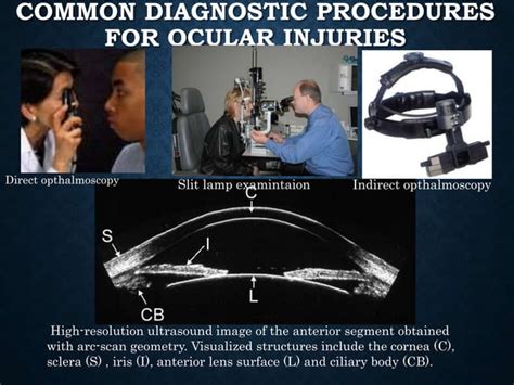 Ocular Trauma Ppt