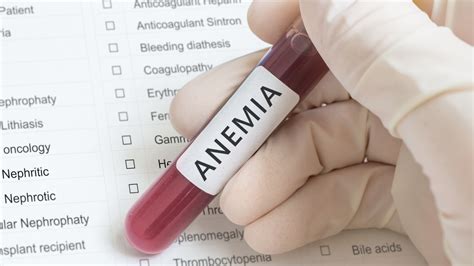 Hemolytic Anemia Causes Symptoms Diagnosis And Treatment