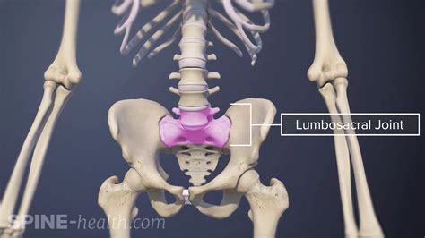 L5-S1 Isthmic Spondylolisthesis Animation | Spine-health