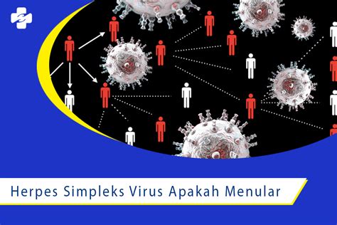 Cara Penularan Herpes Simpleks Virus Klinik Utama Sentosa