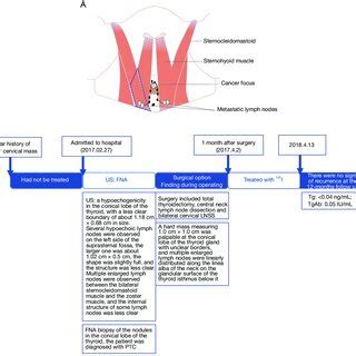 The Schematic Diagrams Of LNSS And Patient S Treatment Timeline A