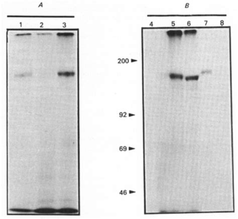 Labelling Of Bradykinin Receptors On Ng 108 15 Cells With N Asa